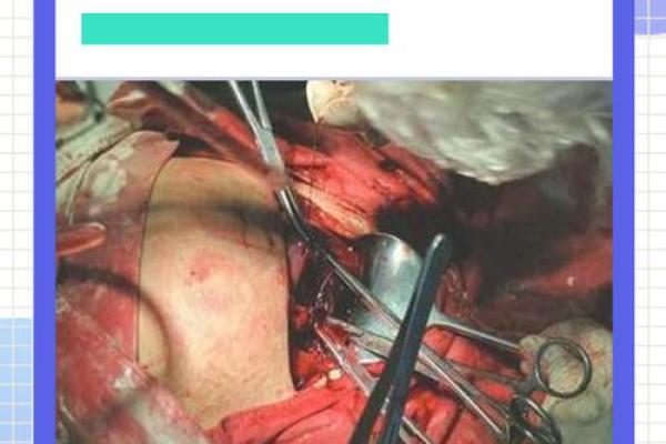 2025年剖腹产妈妈入宅择日指南与风水讲究